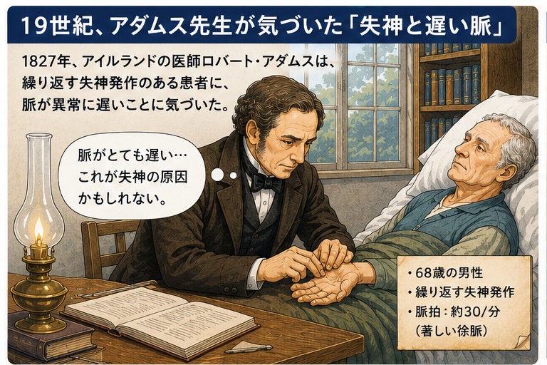 1827年 ロバート・アダムスが失神と異常に遅い脈に気づく(アダムス・ストークス発作の由来)