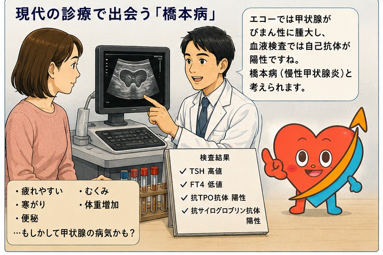 現代の診療で出会う橋本病 甲状腺エコーとTSH・FT4・自己抗体の検査