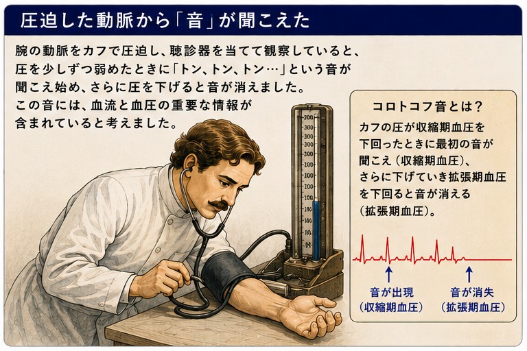 圧迫した動脈から聞こえるコロトコフ音 音が出現する圧が収縮期血圧消える圧が拡張期血圧