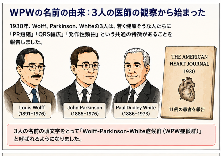 WPWの名前の由来：3人の医師の観察から始まった