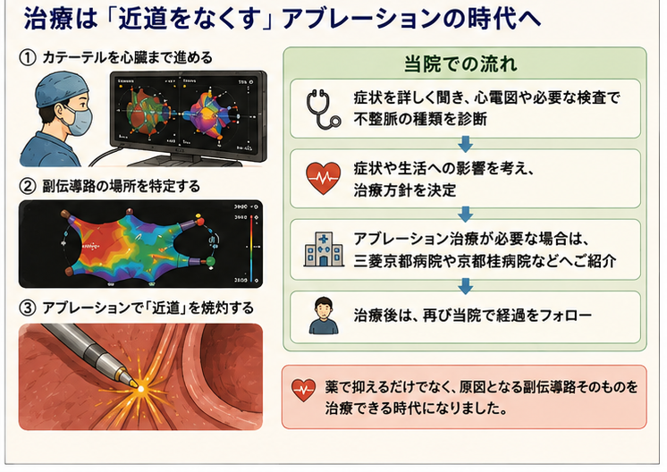 治療は「近道をなくす」アブレーションの時代へ